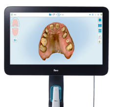 Large PNG-iTero Lumina Pro cart - Full arch, front view-1-1