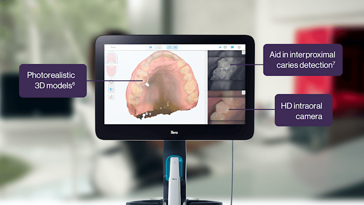 image-text-and-media-iTero-scanner-description
