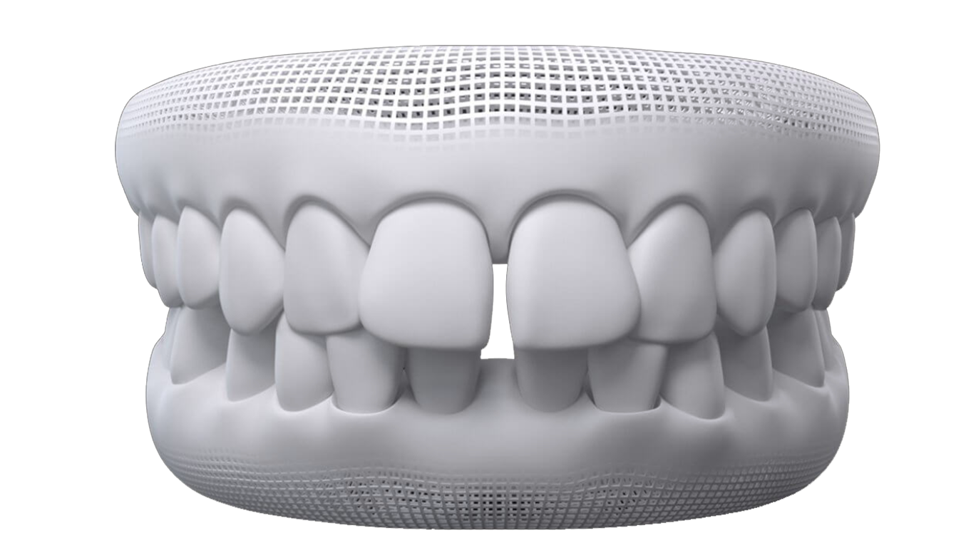 gap-teeth1